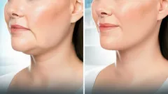 5 prostych ćwiczeń, które zapewniają efekt „wypiętrzonej twarzy” bez pomocy kosmetyczki — już po kilku tygodniach